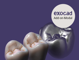 In-CAD-Nesting exocad trusmile-technology