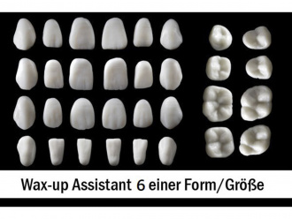Smile Line N-B Large Architect wax-up As.