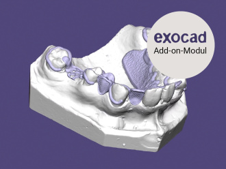 PartialCAD exocad Module 1