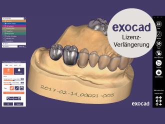 exocad Screenshot 1 License renewal