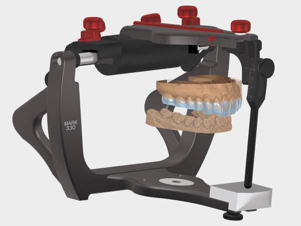 exocad Bite Splint Module | Gold Quadrat Dental