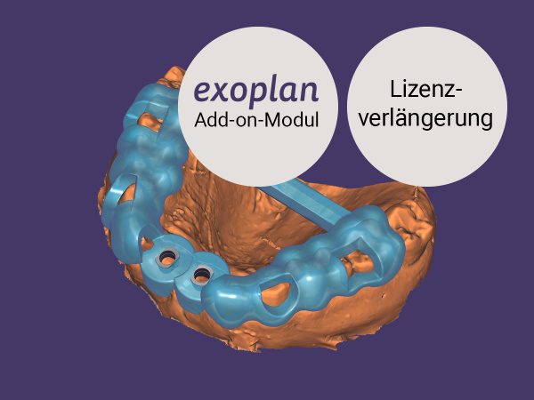 exoplan Guide Creator Add-on Modul