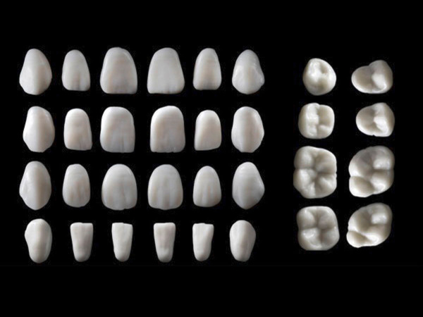 Smile Line N-Upper Small Architect wax-up Posterio